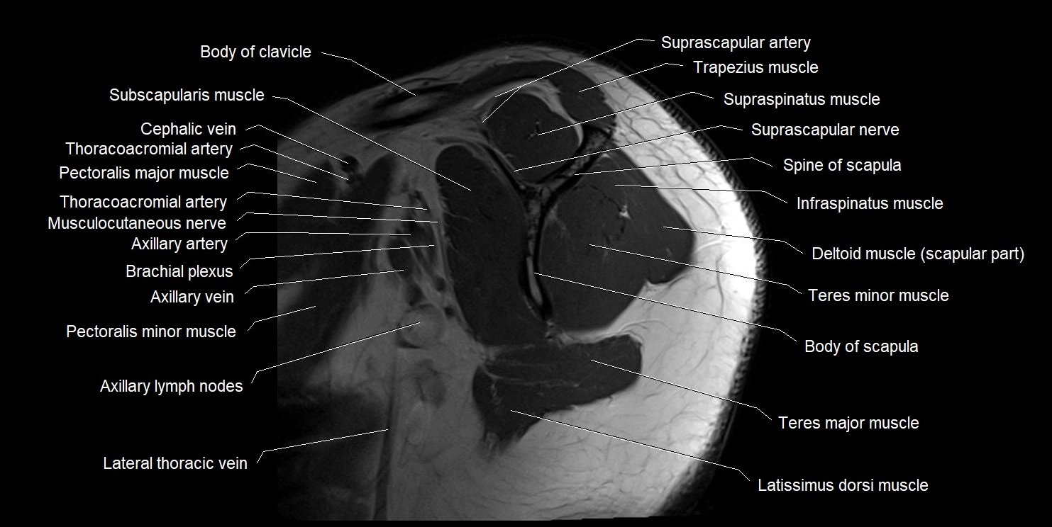 mri shoulder sagittal cross sectional anatomy image 1.webp